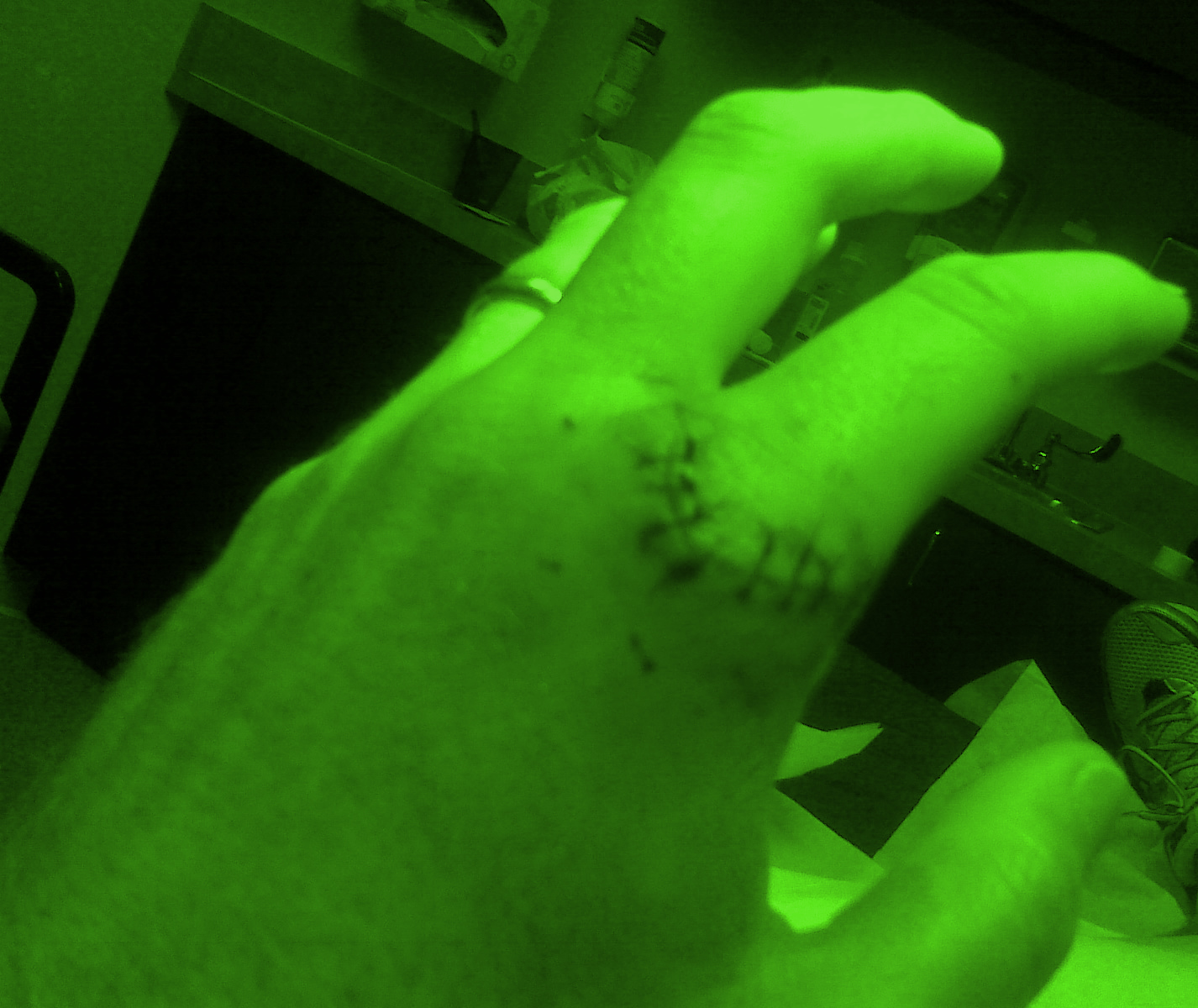 Healthcare Customer Service | Hand Stitches